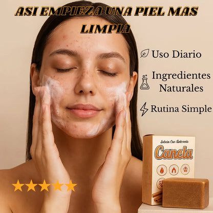 3 Jabones Canela Elimina Imperfecciones + 1 De Regalo