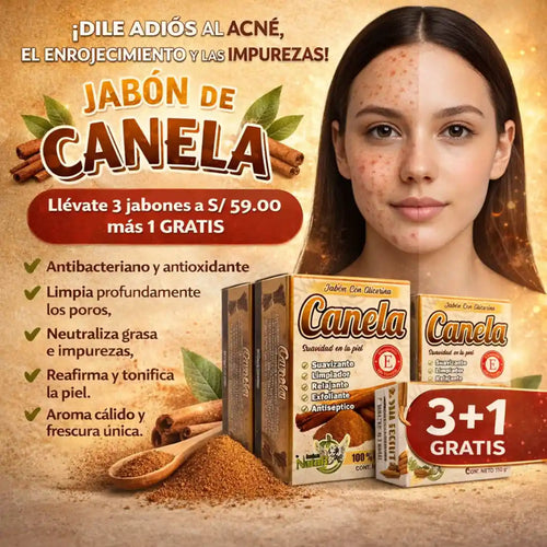 3 Jabones Canela Elimina Imperfecciones + 1 De Regalo
